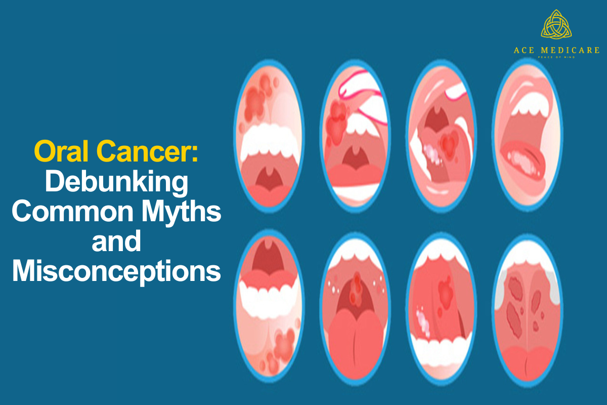 Oral Cancer: Debunking Common Myths and Misconceptions